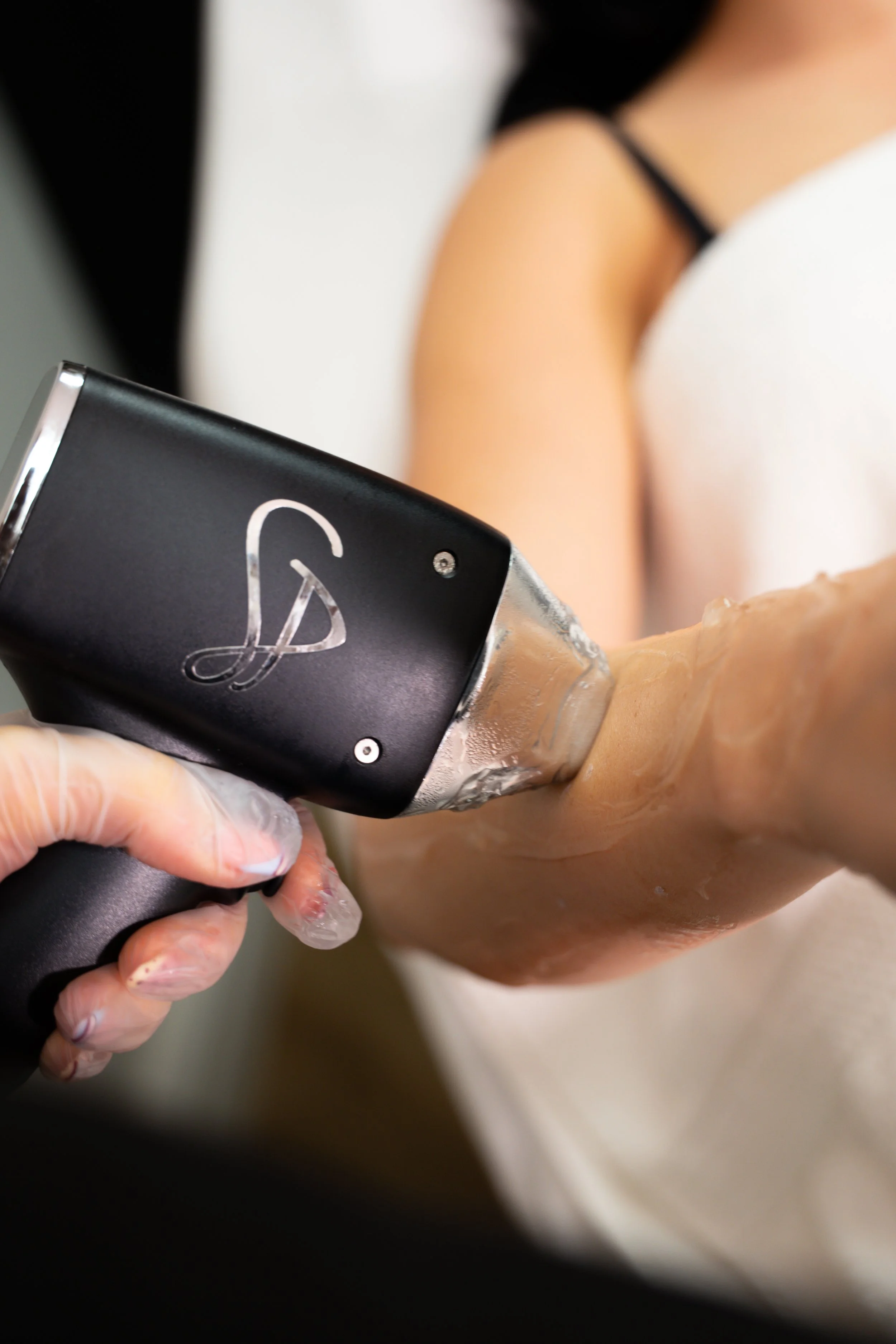 Close-up of a laser hair removal treatment on the arm, as taught at The Laser Base Training Academy.