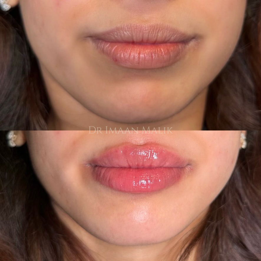 Dr Imaan Malik (5).png