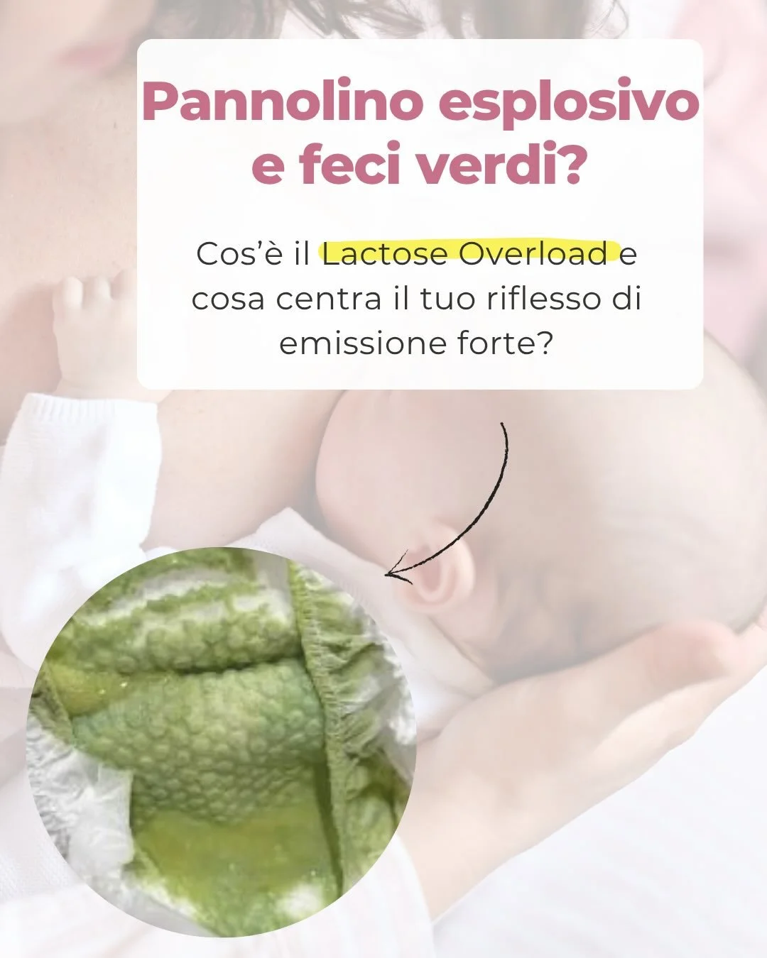 💩Le feci del neonato spesso ci preoccupano molto.. 
Verdi, schiumose, con muco&hellip; ma cosa significano davvero?

La cosa pi&ugrave; importante &egrave; questa:
👉🏻le feci non vanno mai interpretate da sole!

Per capire davvero cosa sta succeden