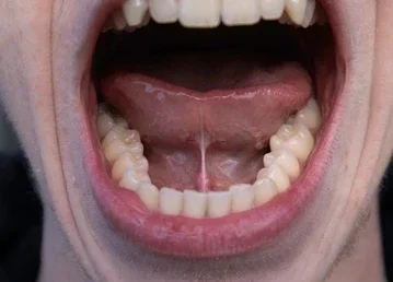 Open mouth showing teeth and tongue inside