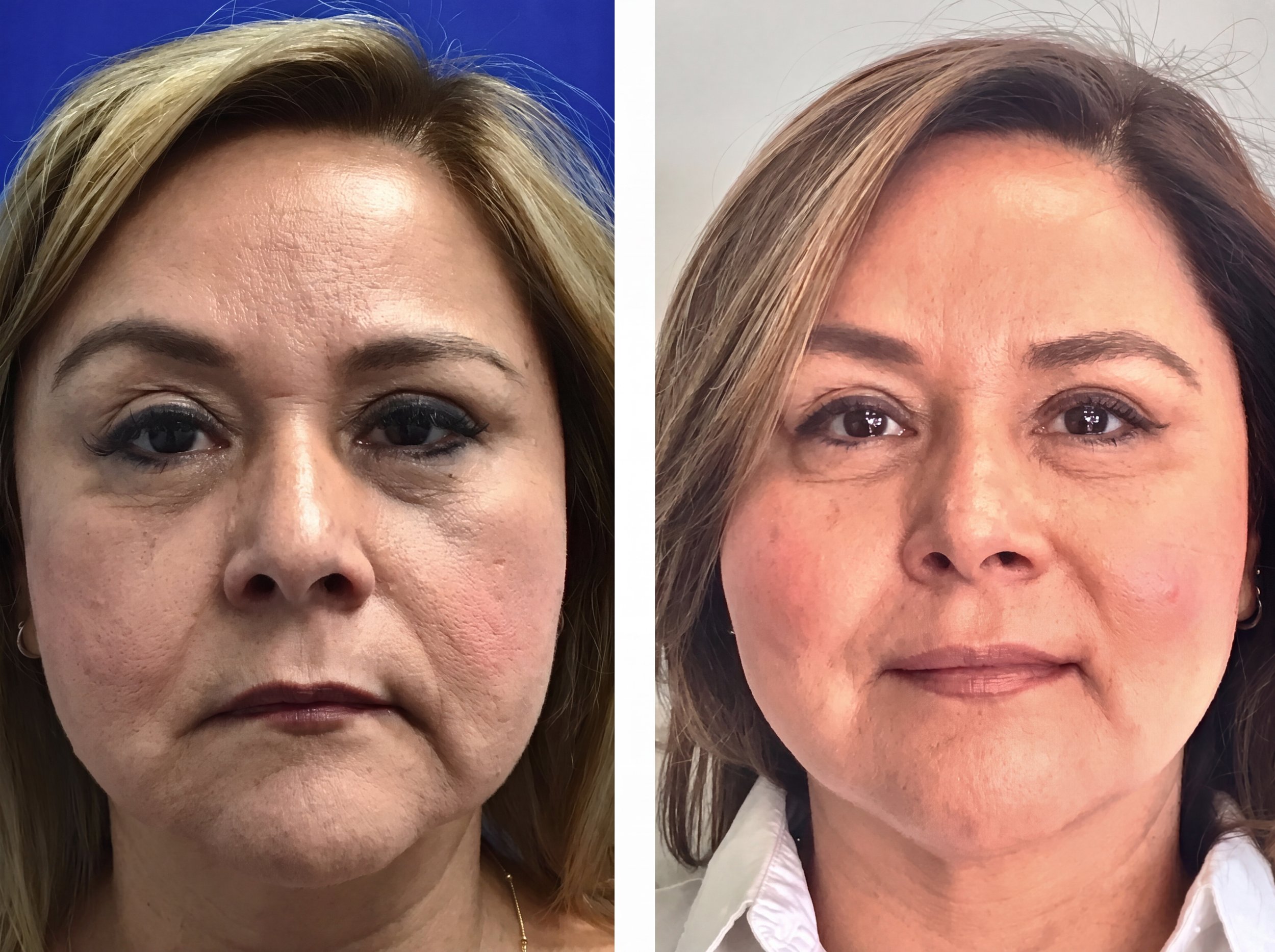 Face_before-and-after.jpg