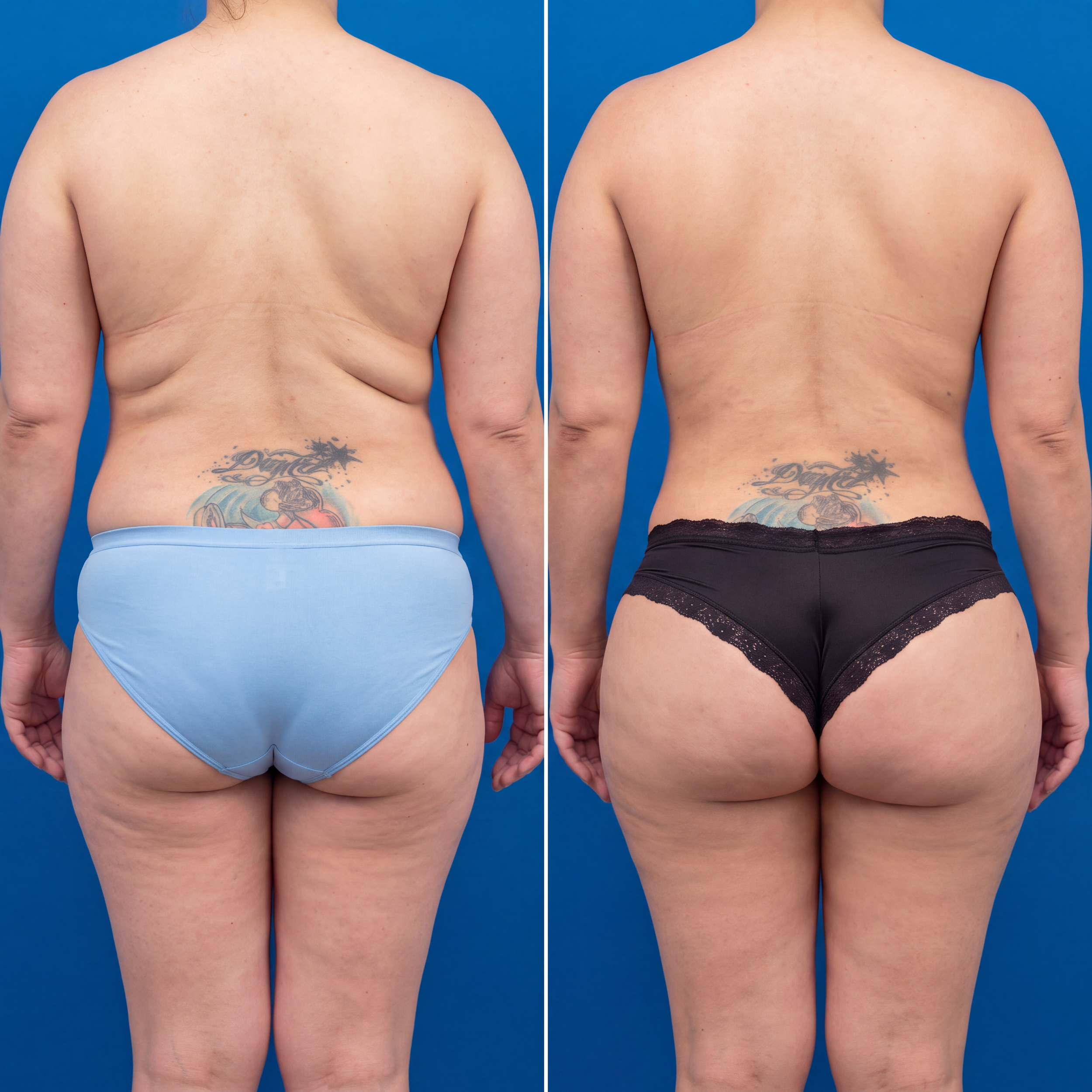 smooth butt on right.png
