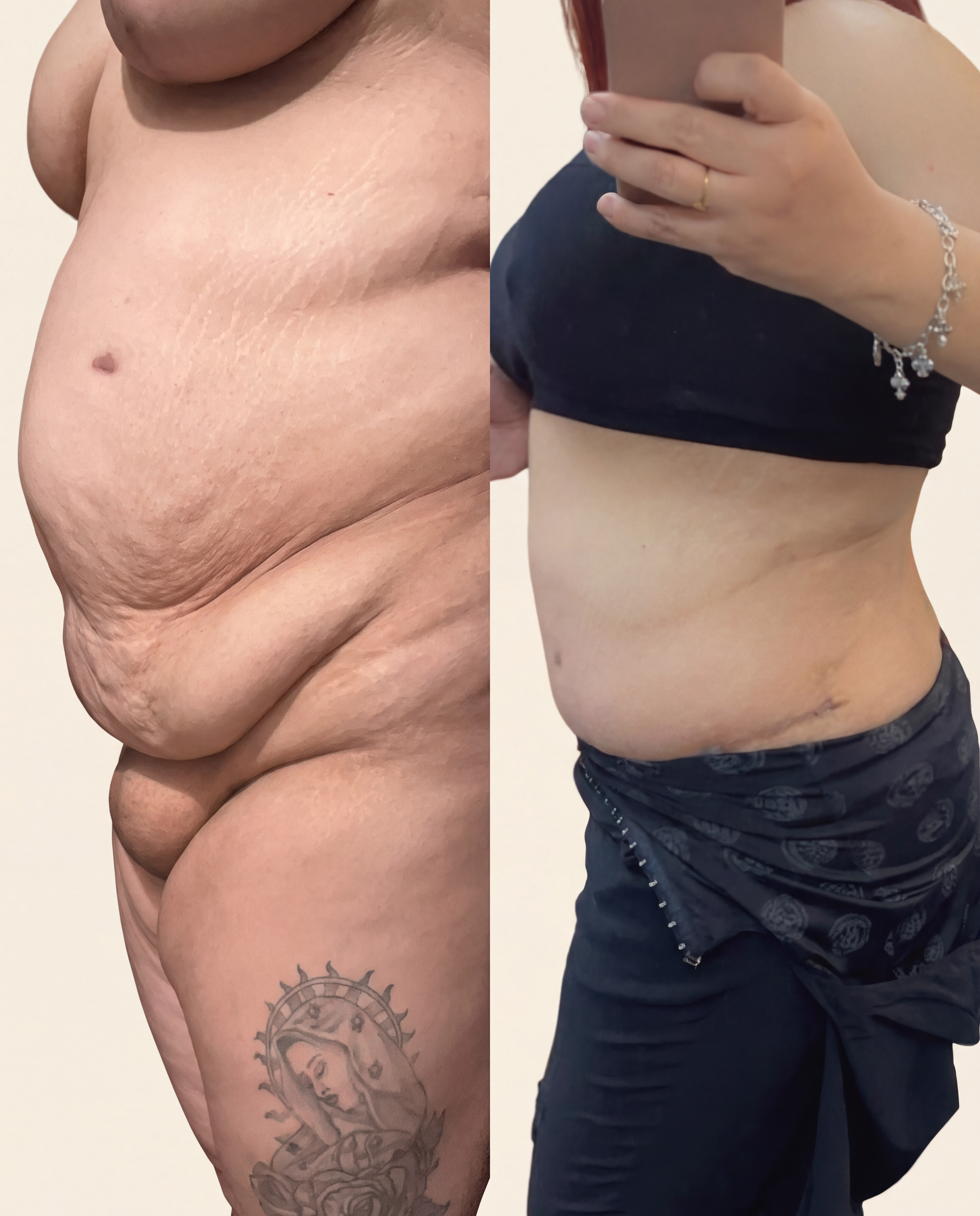 before and after.png