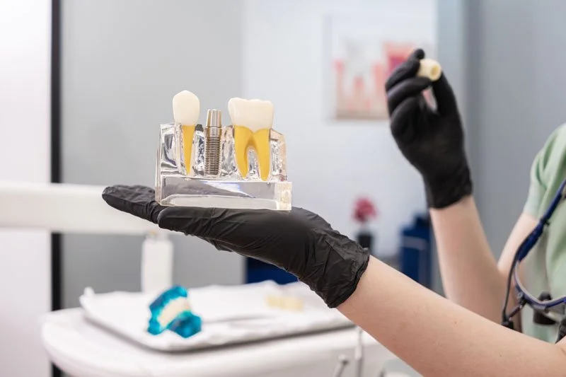 Navigating the World of Dental Implants: An Expert's Guide