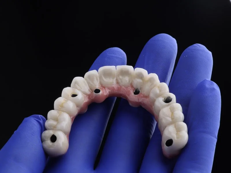 Navigating the World of Surgery Dental in Abilene, Texas