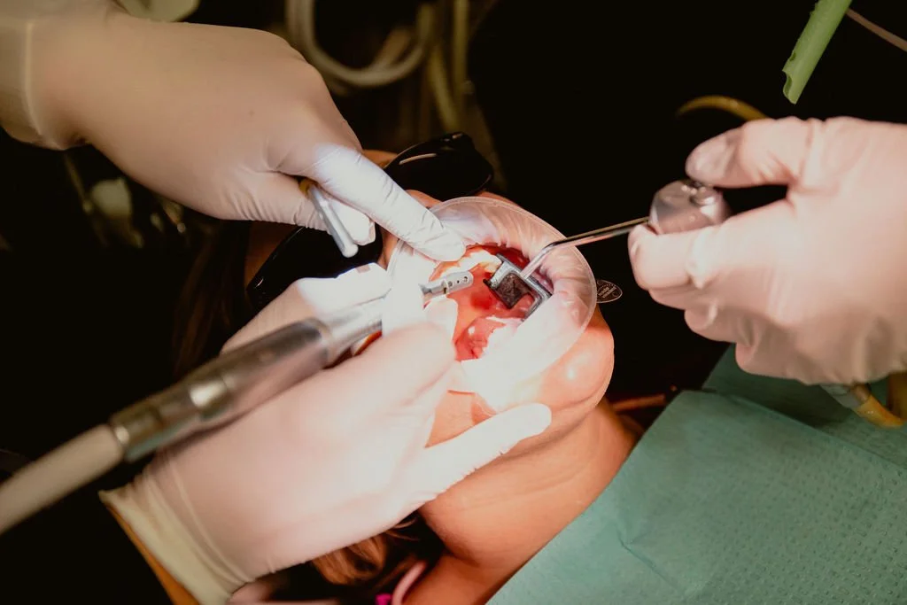 Dental team performing oral surgery on a patient's mouth with various instruments.