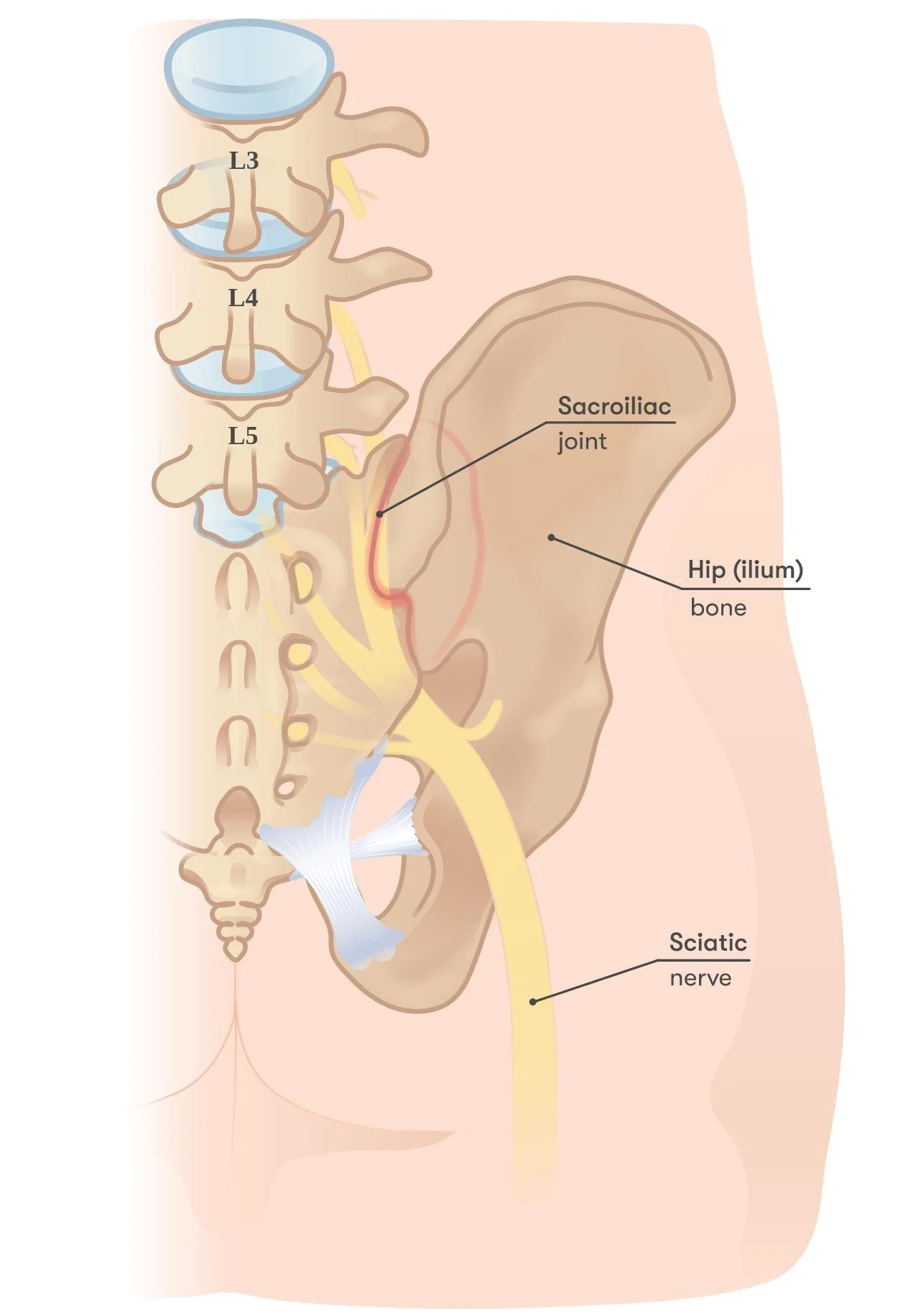 An anatomical illustration of the human lower back and pelvis showing lumbar vertebrae L3, L4, L5, sacroiliac joint, hip (ilium) bone, and sciatic nerve.