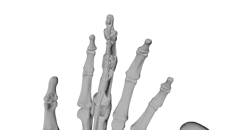 3D Modeling & Medical Sculpture