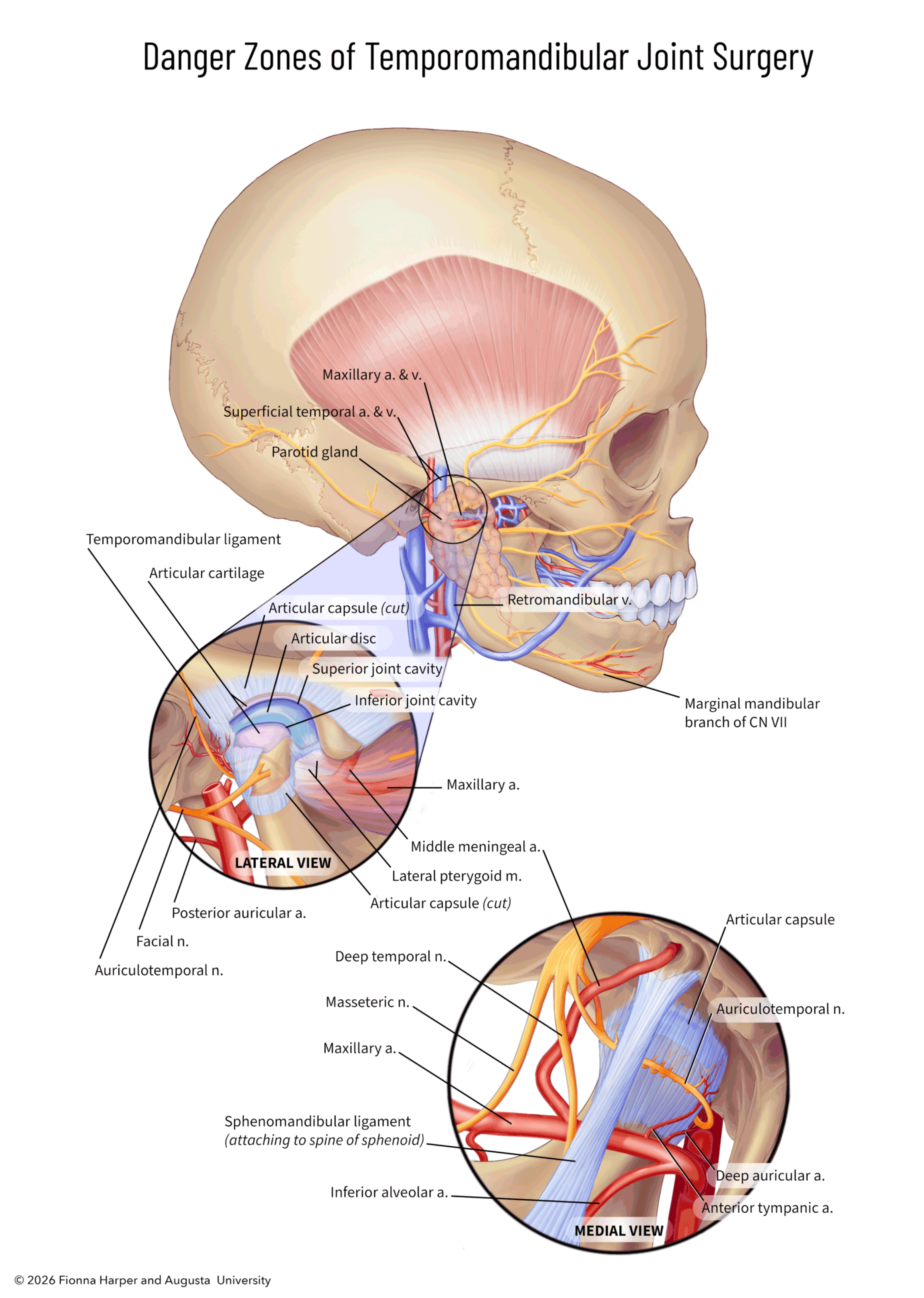 This piece was created as part of the comprehensive exams administered to us in the program. The purpose of this piece was to illustrate notable anatomical features that can present complications during TMJ surgery.
This piece was developed using Pho