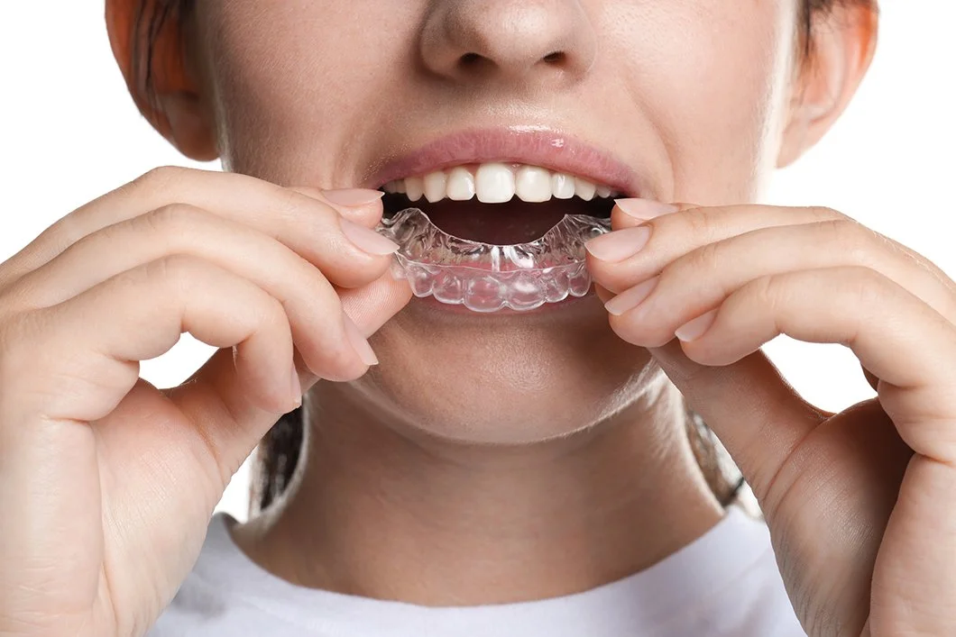 Person placing a clear dental night guard in their mouth