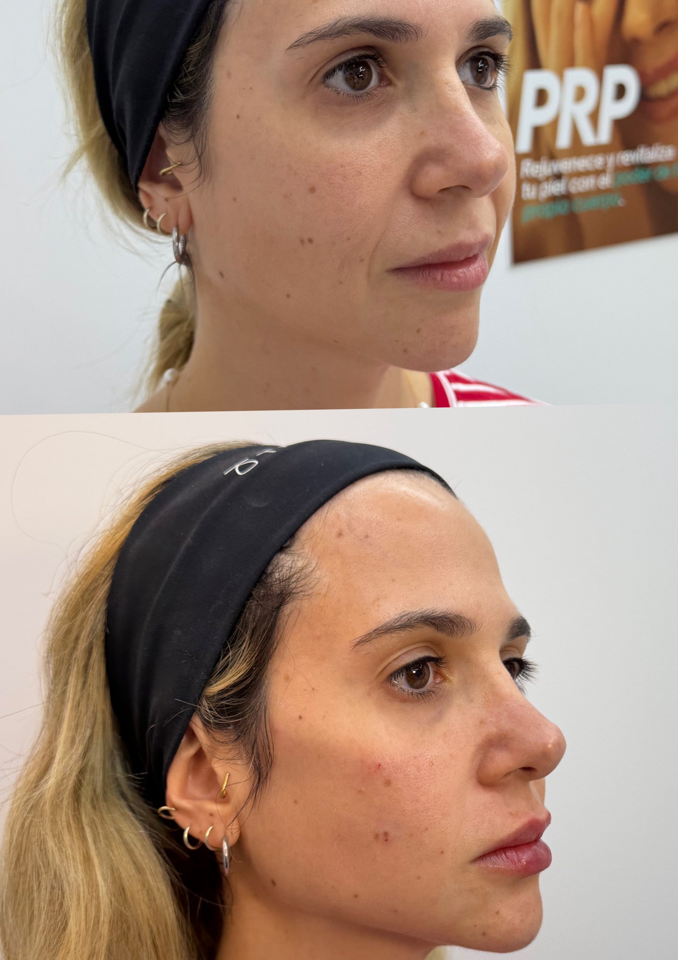 Mujer con cabello rubio y ojos marrones, usando una diadema negra y múltiples aretes en la oreja izquierda, en un fondo con cartel de PRP en español.