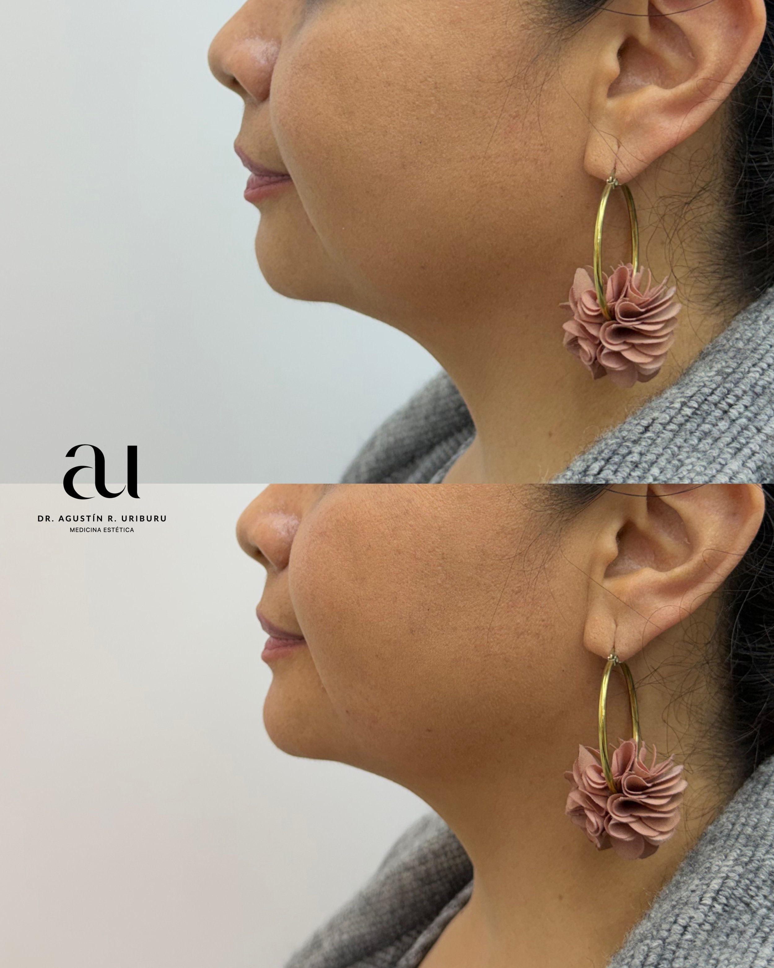 Primer plano de perfil de mujer con oreja, usando pendiente de aro con adorno de flor rosa y ropa gris
