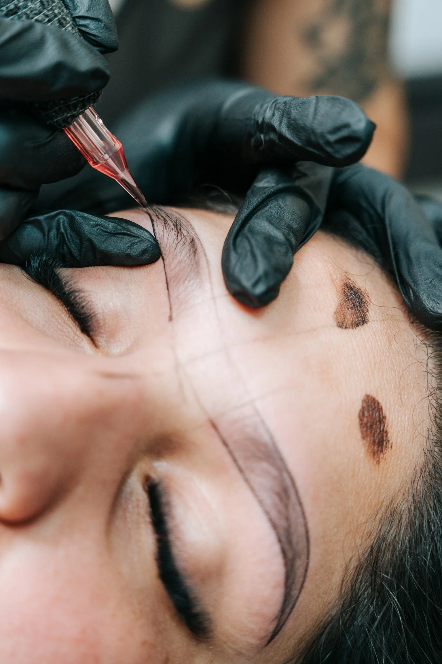 A person receiving an eyebrow tattooing procedure with a tattoo artist using a tattoo pen, while wearing black gloves, on their forehead near two moles.