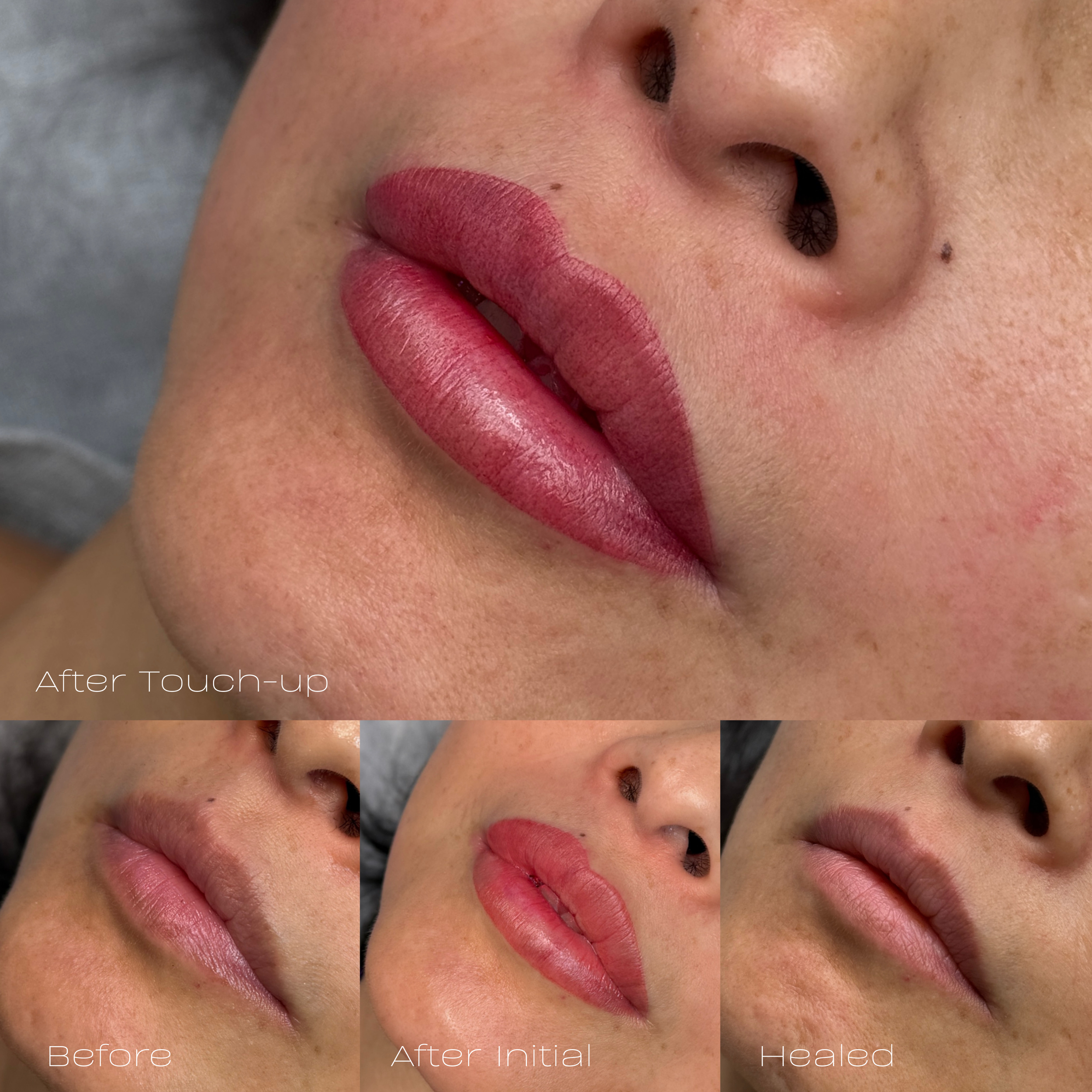 Close-up of lips, showing the process of a lip touch-up treatment, with a comparison of before, after initial, and healed stages.