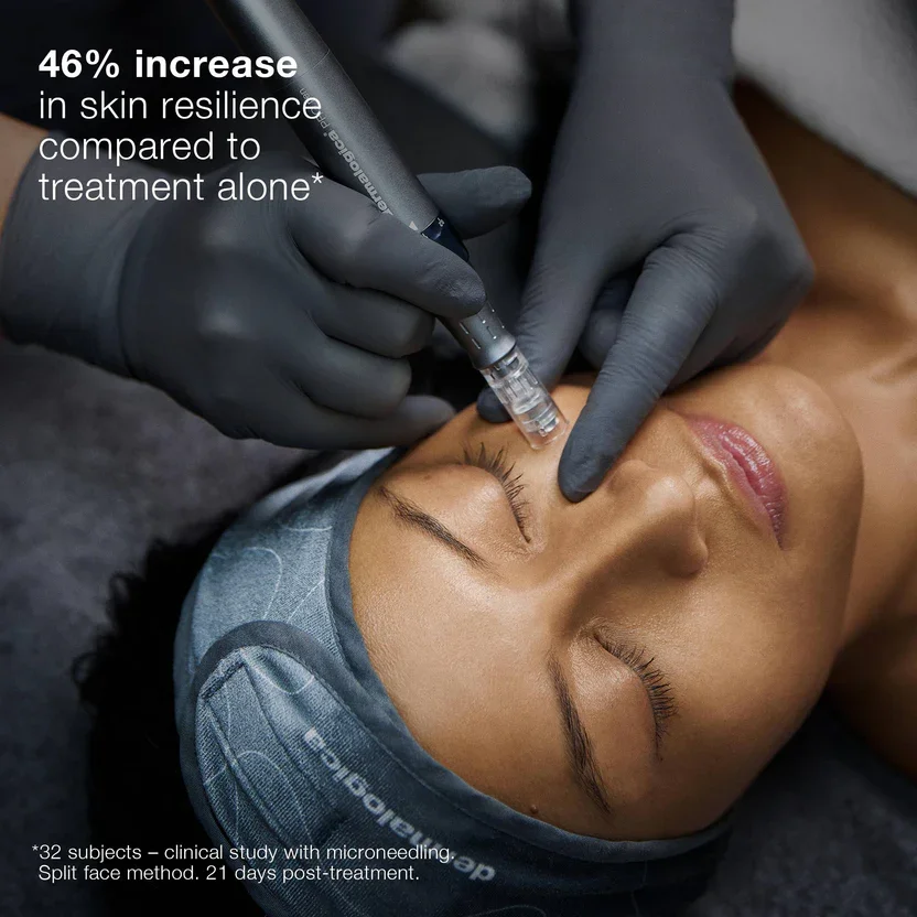 exosome-microneedling-fulham-west-london