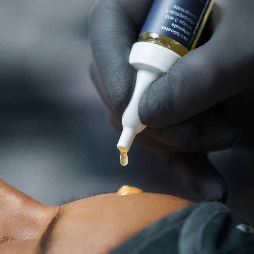 exosome-microneedling-fulham-west-london-exobooster