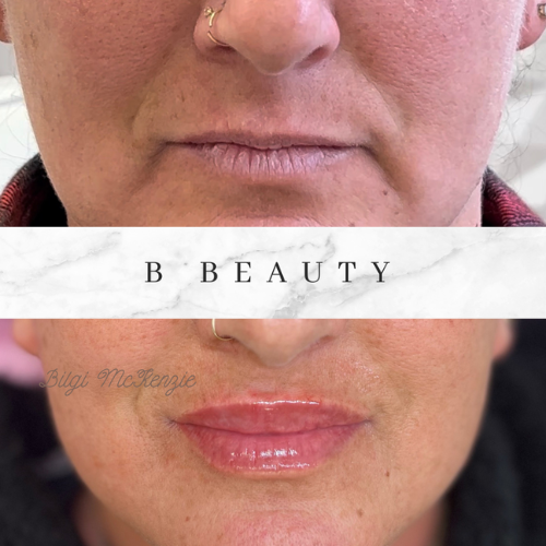 bbeauty-before-after (4).png