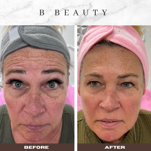 bbeauty-before-after (3).png