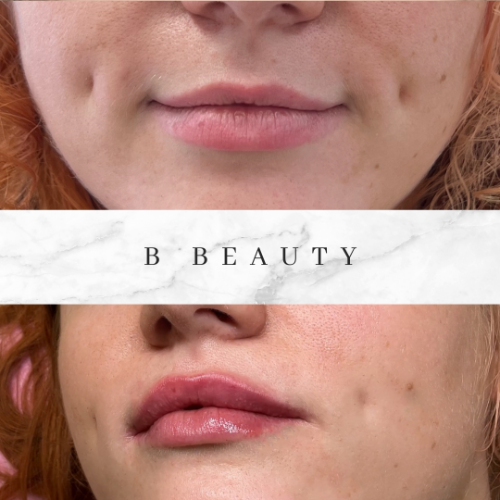 bbeauty-before-after (2).png
