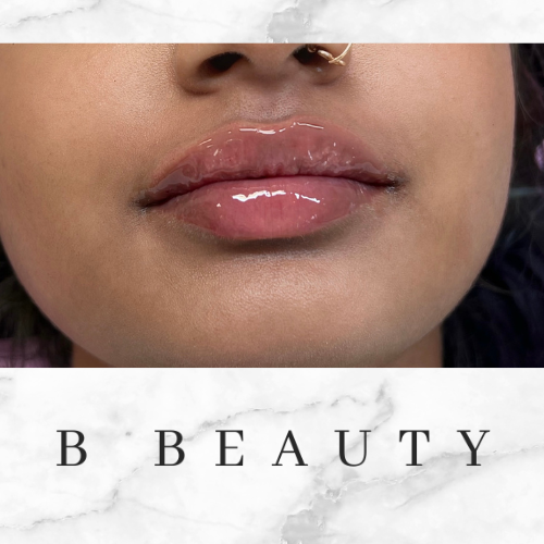bbeauty-before-after.png