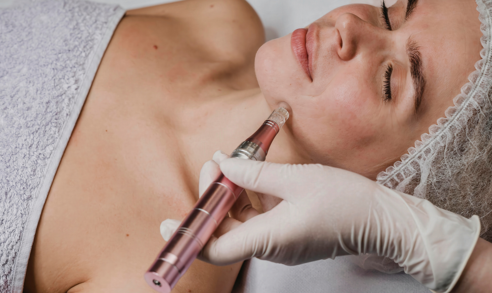 Medspa in Fishers, IN, 46237  Microneeedling Near Me