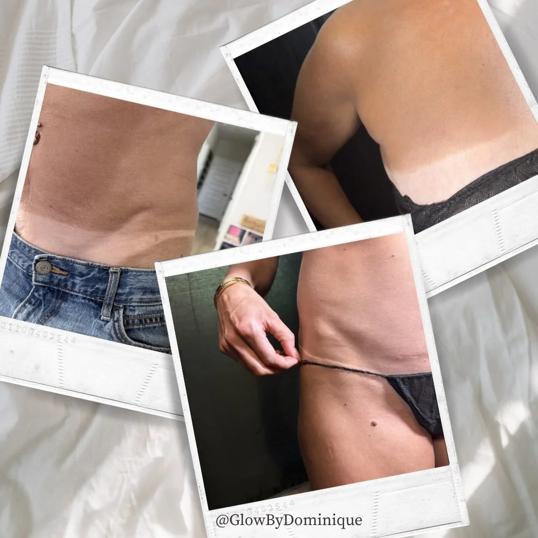 Clean. Crisp. Seamless. ✨

This is what a true custom glow looks like&mdash;
no harsh lines, no orange tones&hellip; just skin that looks like you, but better.

Whether you choose Rapid or Traditional, the goal is always the same:
🤎 A natural, even 