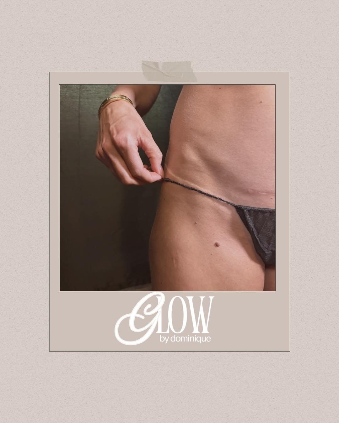 clean lines only ✨
#WellenPark #VeniceFL #SprayTan #FlawlessTan #GlowUpSkin