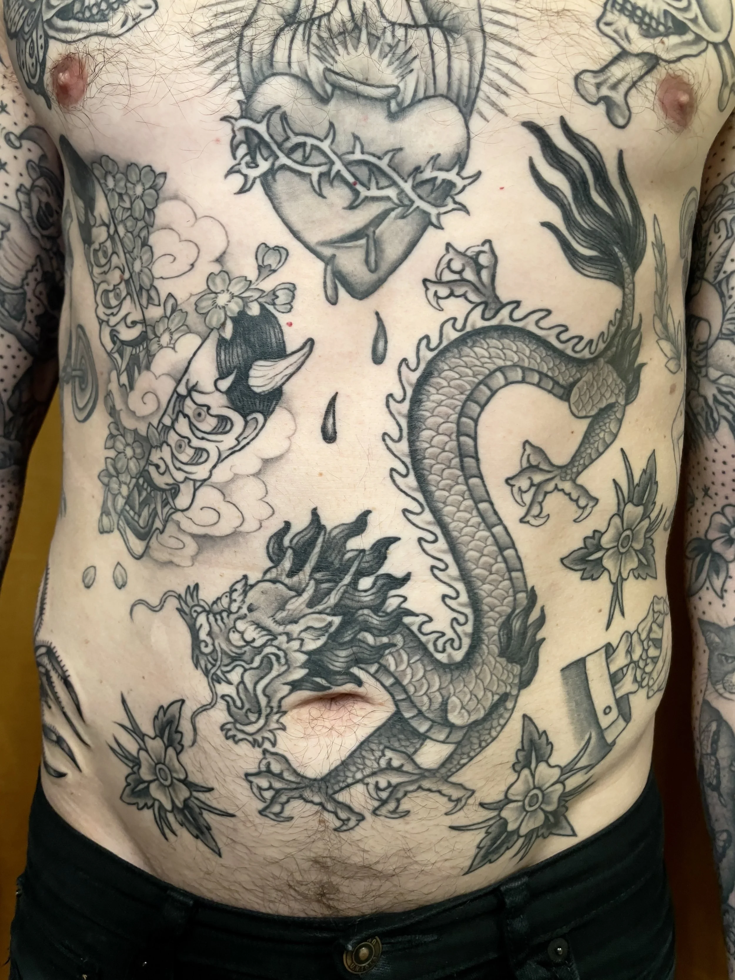 Healed stomach dragon