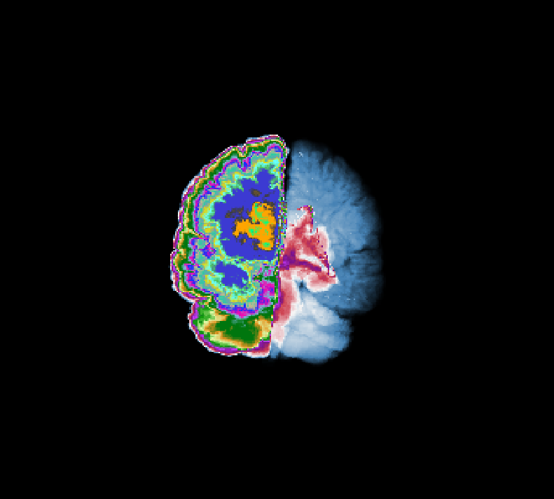 Brains