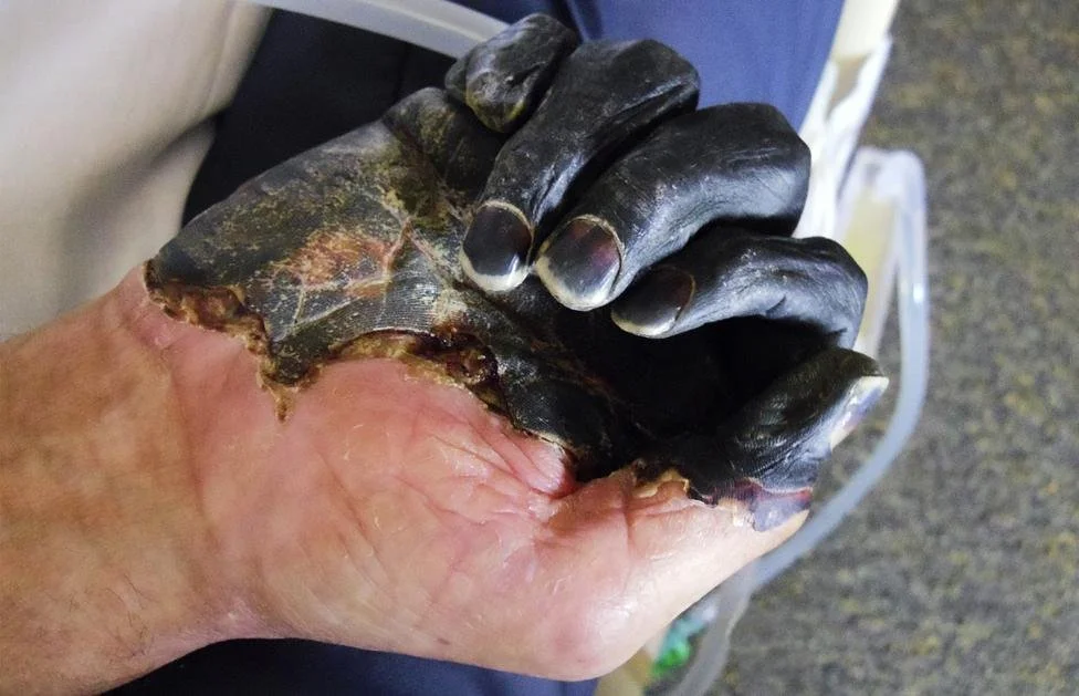 black plague hand.jpg