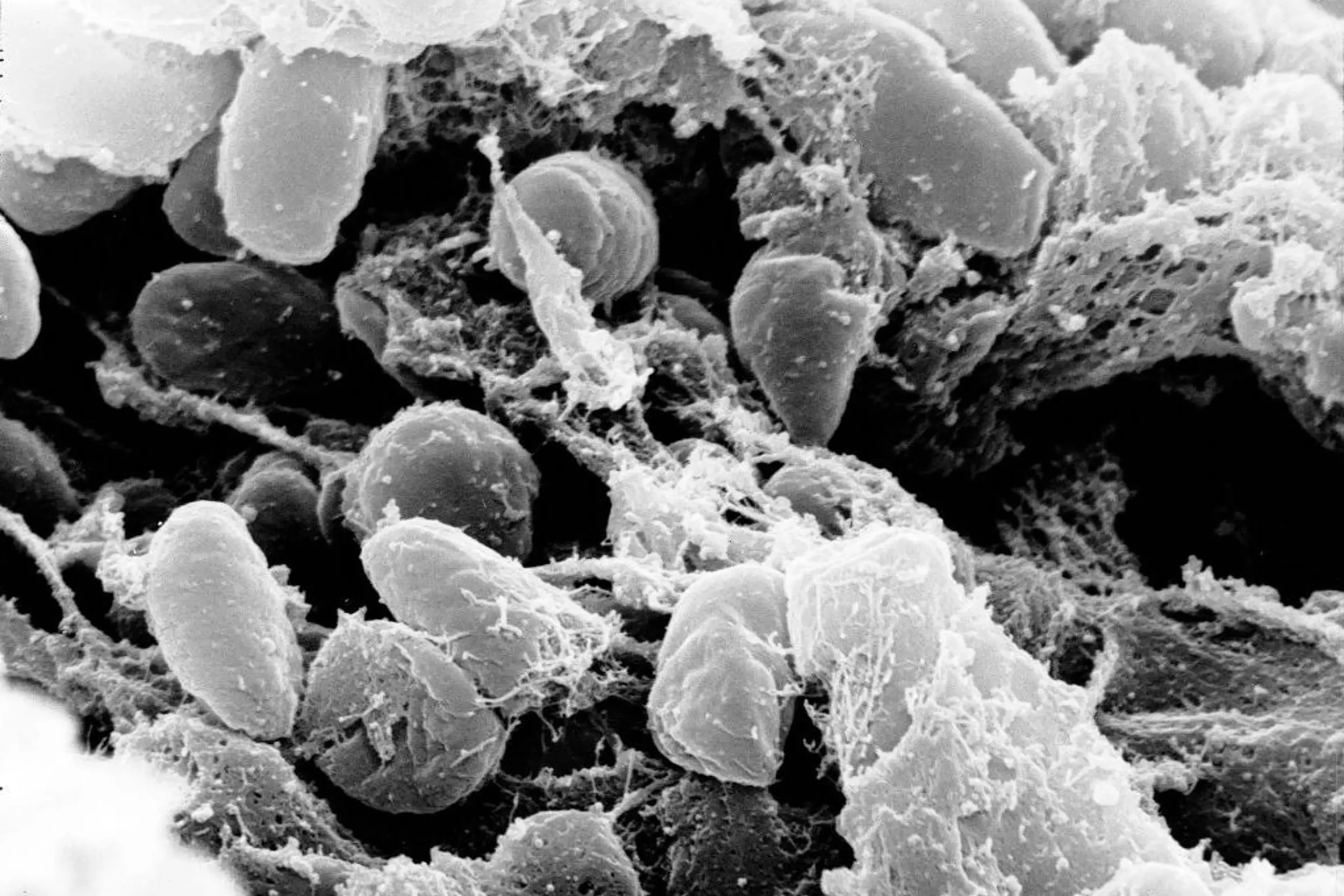 genes plague.webp