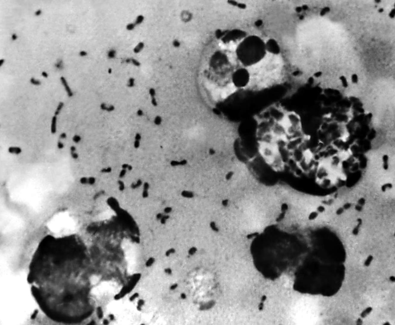 bubonic plague gene.png