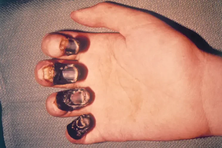 black nails.webp