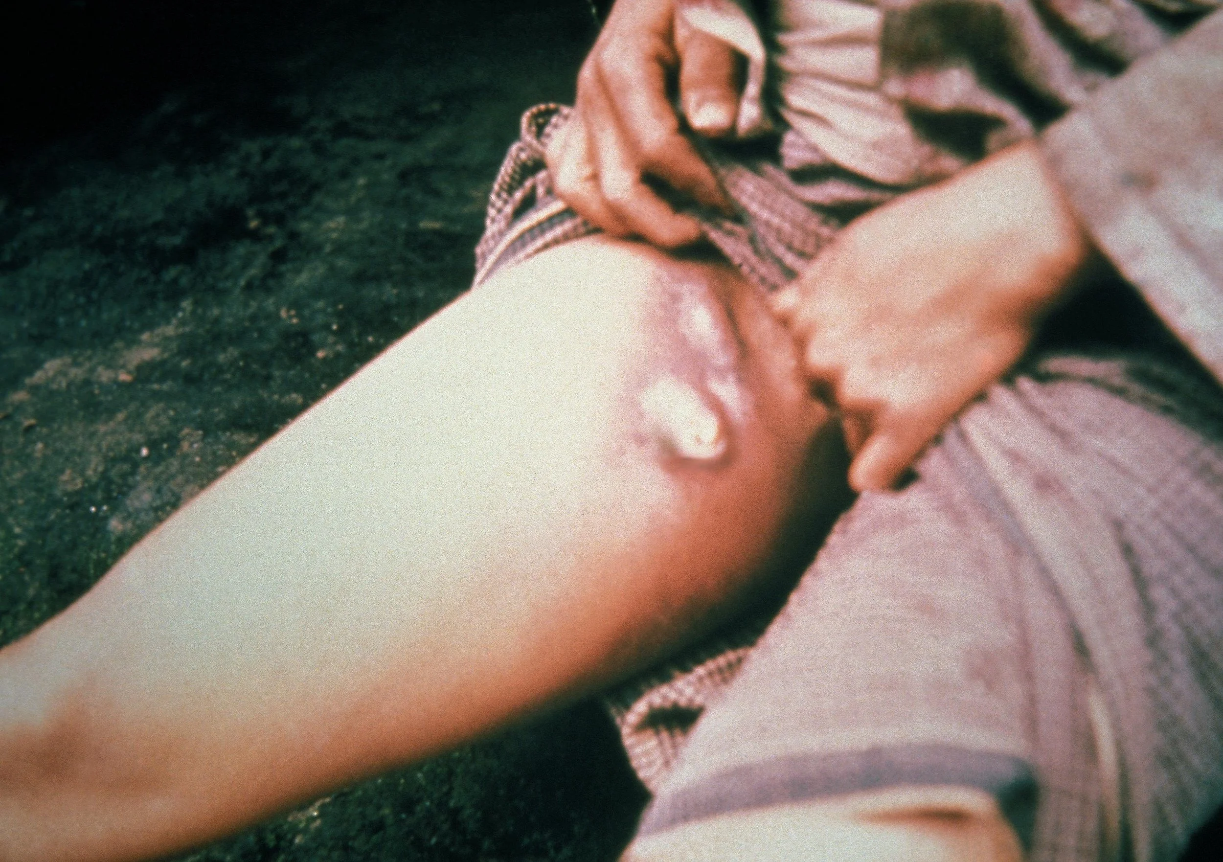 old plague pic.jpg