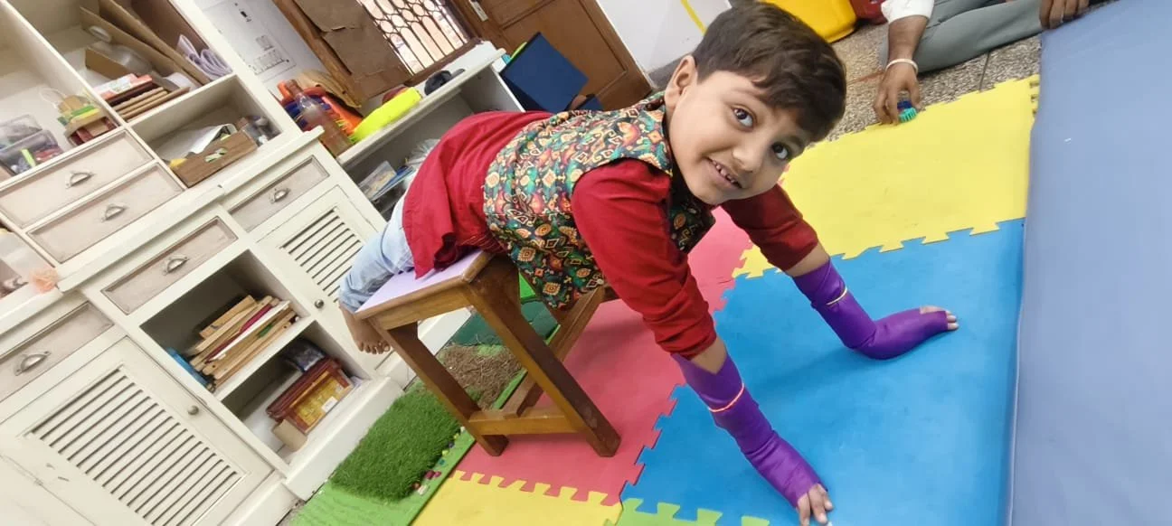 A young boy is crawling on colorful foam mats in a playroom, smiling at the camera, with a purple cast on both arms.