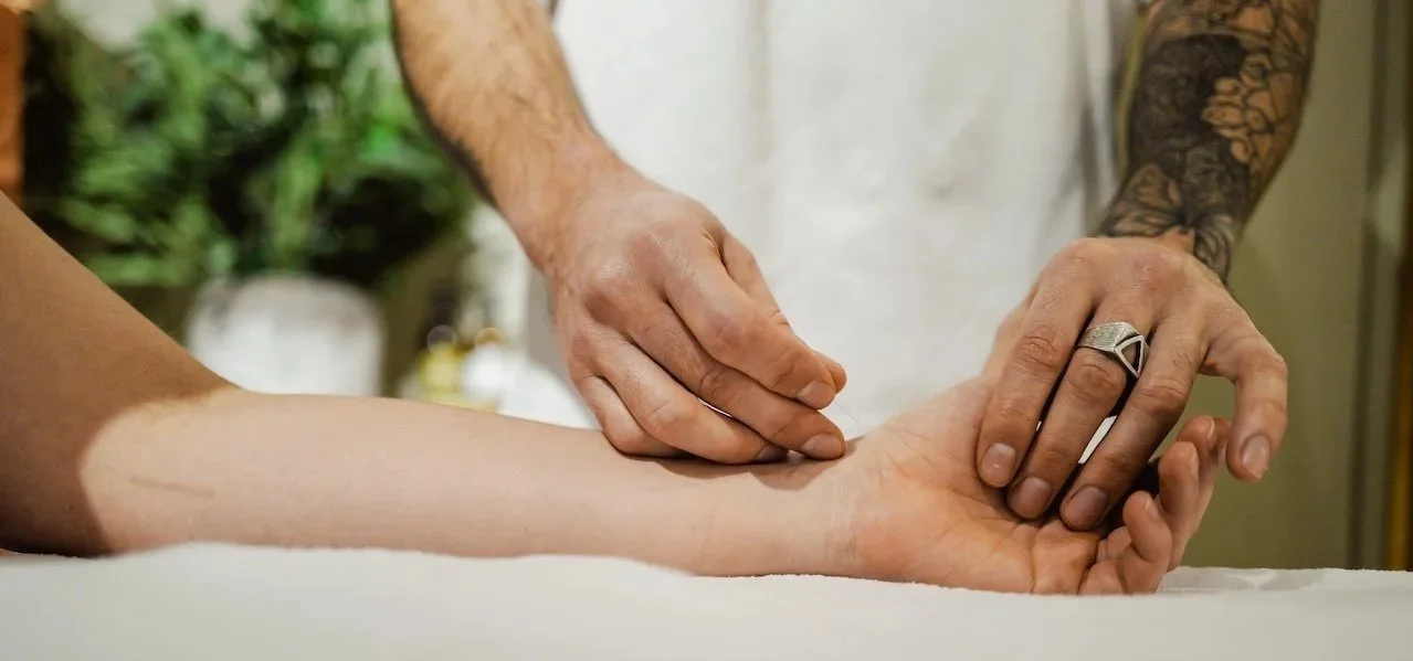 Acupuncture in Amsterdam