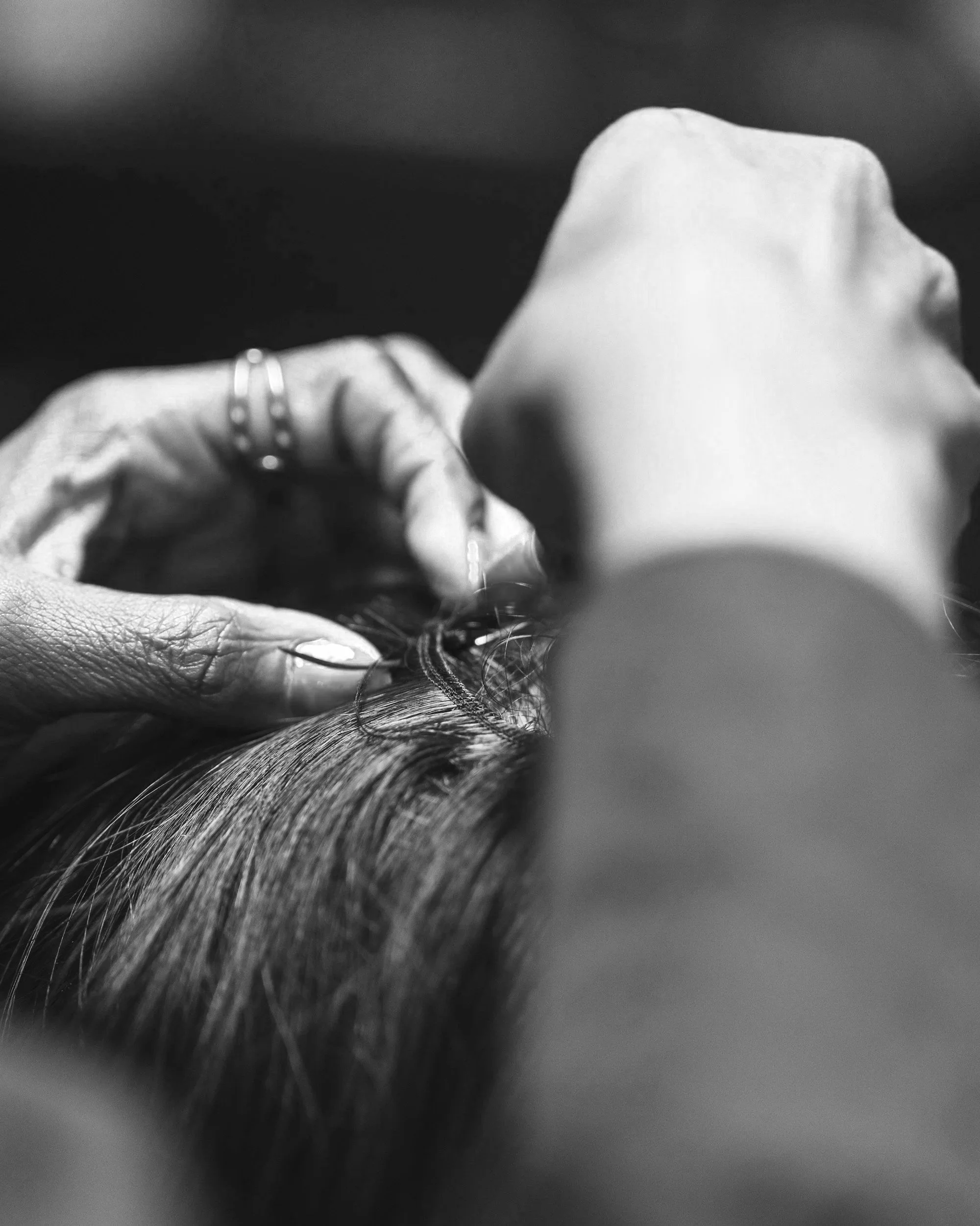 Acupuncture in Amsterdam