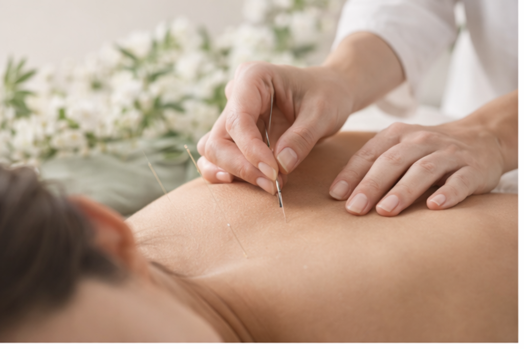 Practitioner performing acupuncture on a patient's back in a clinical setting.