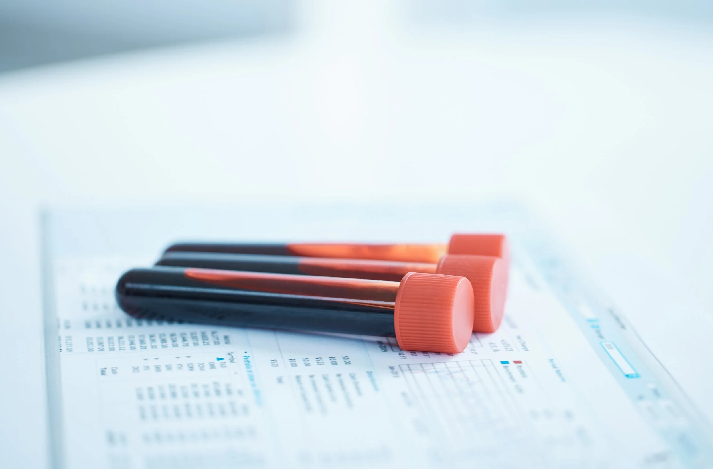 lab vials tubes for blood draw