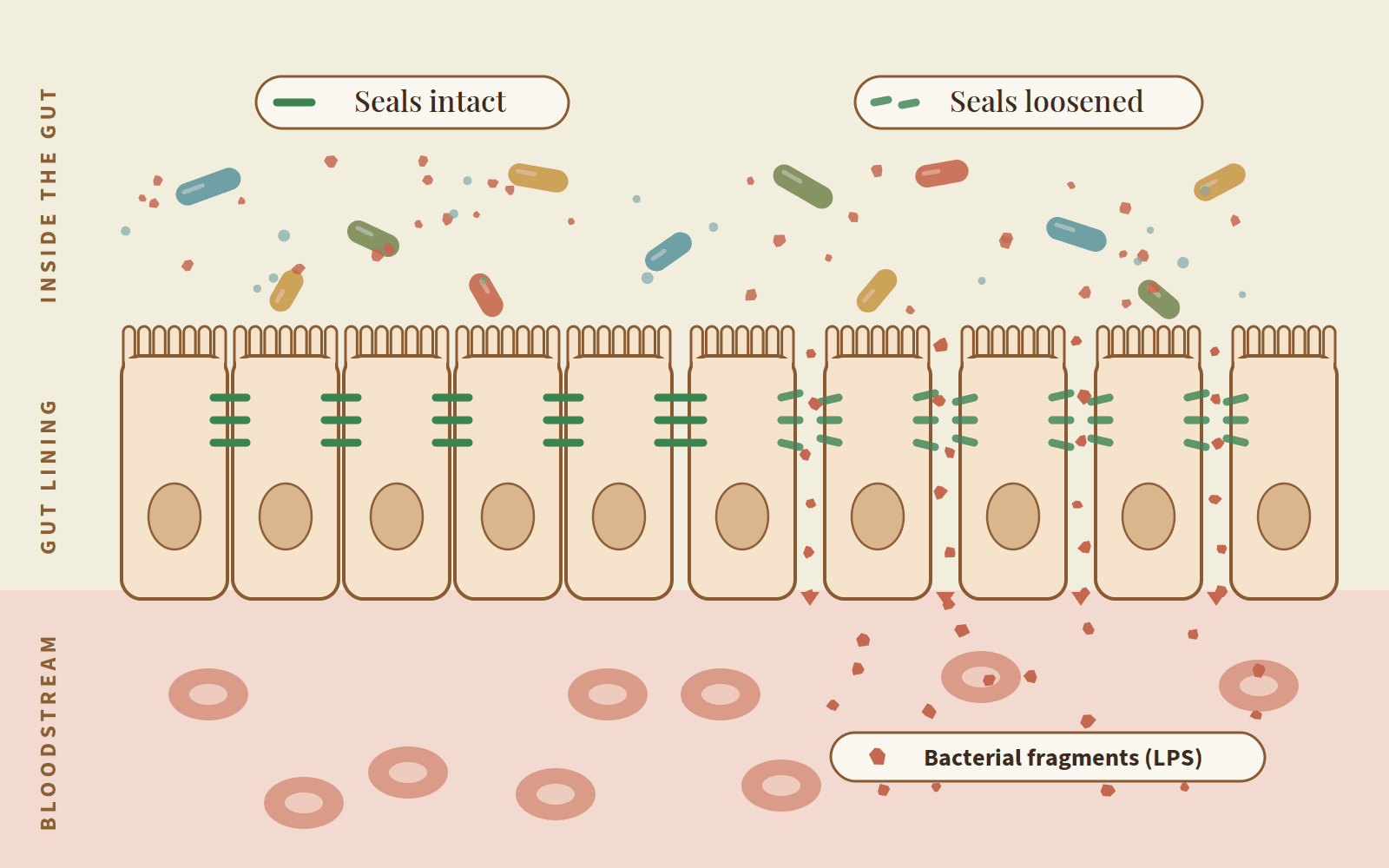 Is Modern Medicine Catching Up? Leaky Gut, Shoulder Pain and a 2,000-Year-Old Medical Text