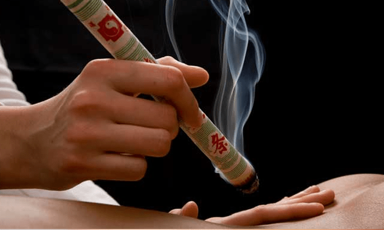 Moxibustion photo.png