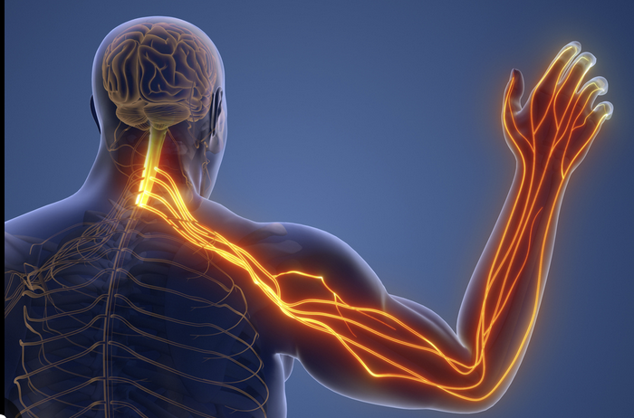 Ruling in Cervical Radiculopathy with an update cluster