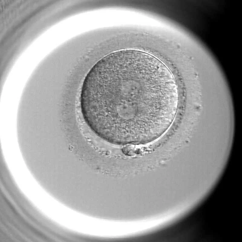 Microscopic view of a human egg cell in a laboratory setting.