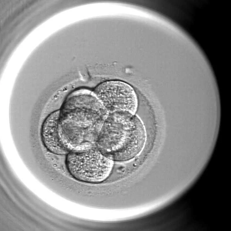 Multiple cells viewed through a microscope in black and white.