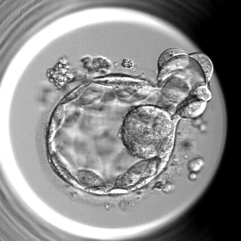 View of a human egg cell fertilized by a sperm cell, seen under a microscope.