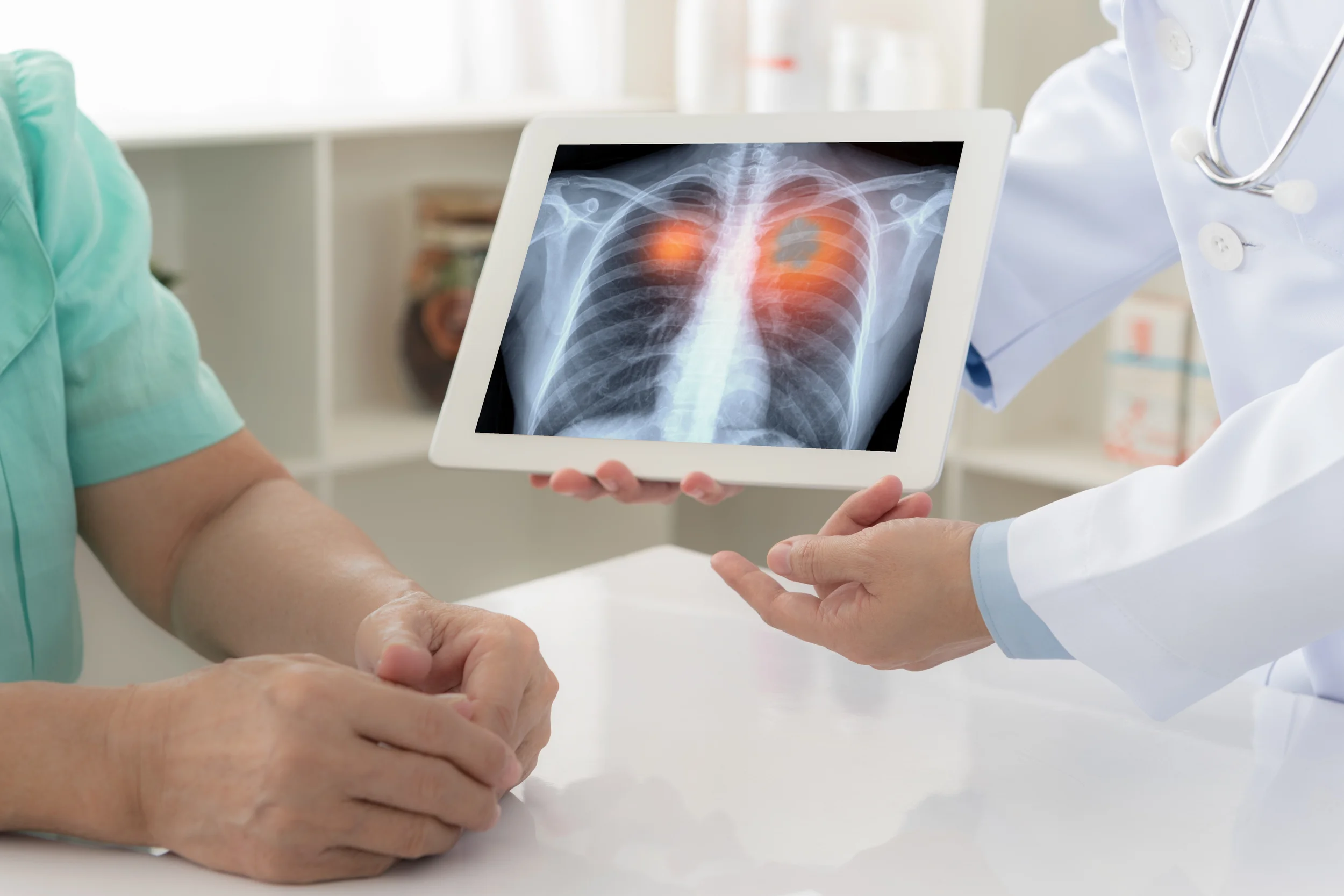 A healthcare professional shows an X-ray of a person's chest, highlighting the lungs, to a patient in a medical setting.