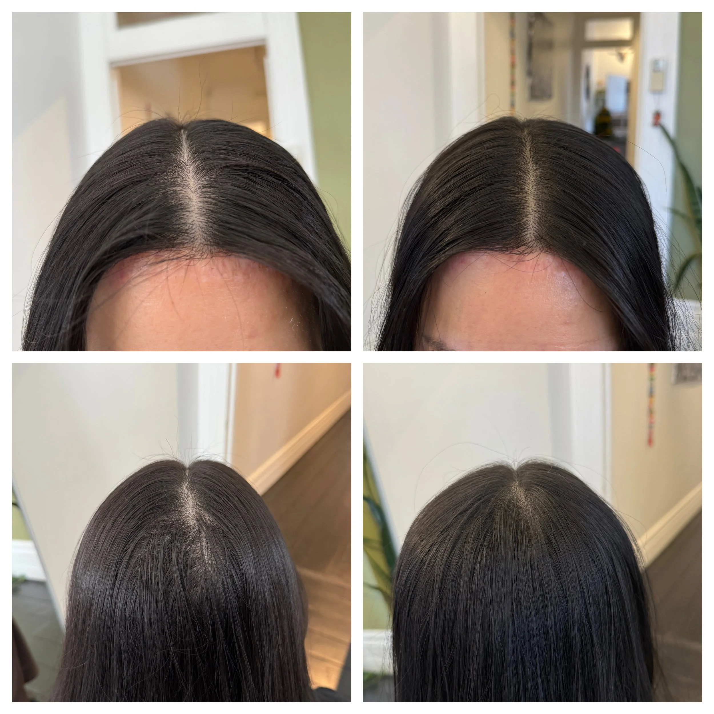 Comparison of a person's dark brown hair before and after treatment, showing improved hair health and shine.