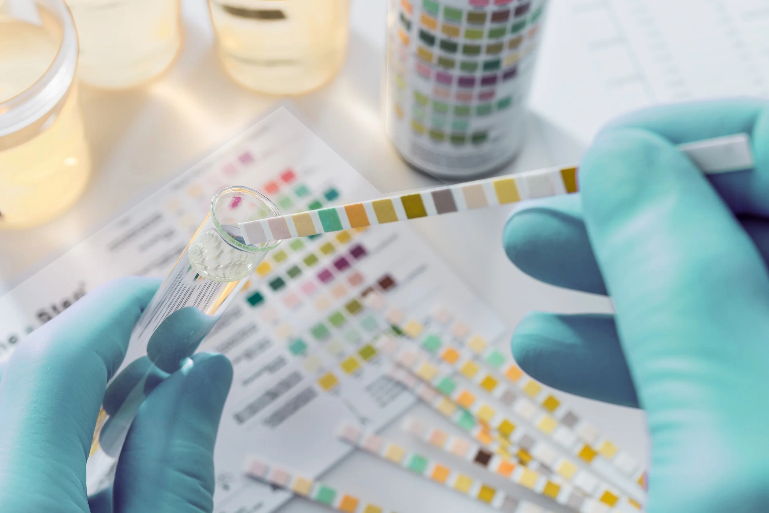   Toxicology Testing (Urine & Blood)
   Comprehensive urine and blood toxicology analysis designed to detect substance use with precision, reliability, and clinical confidence.