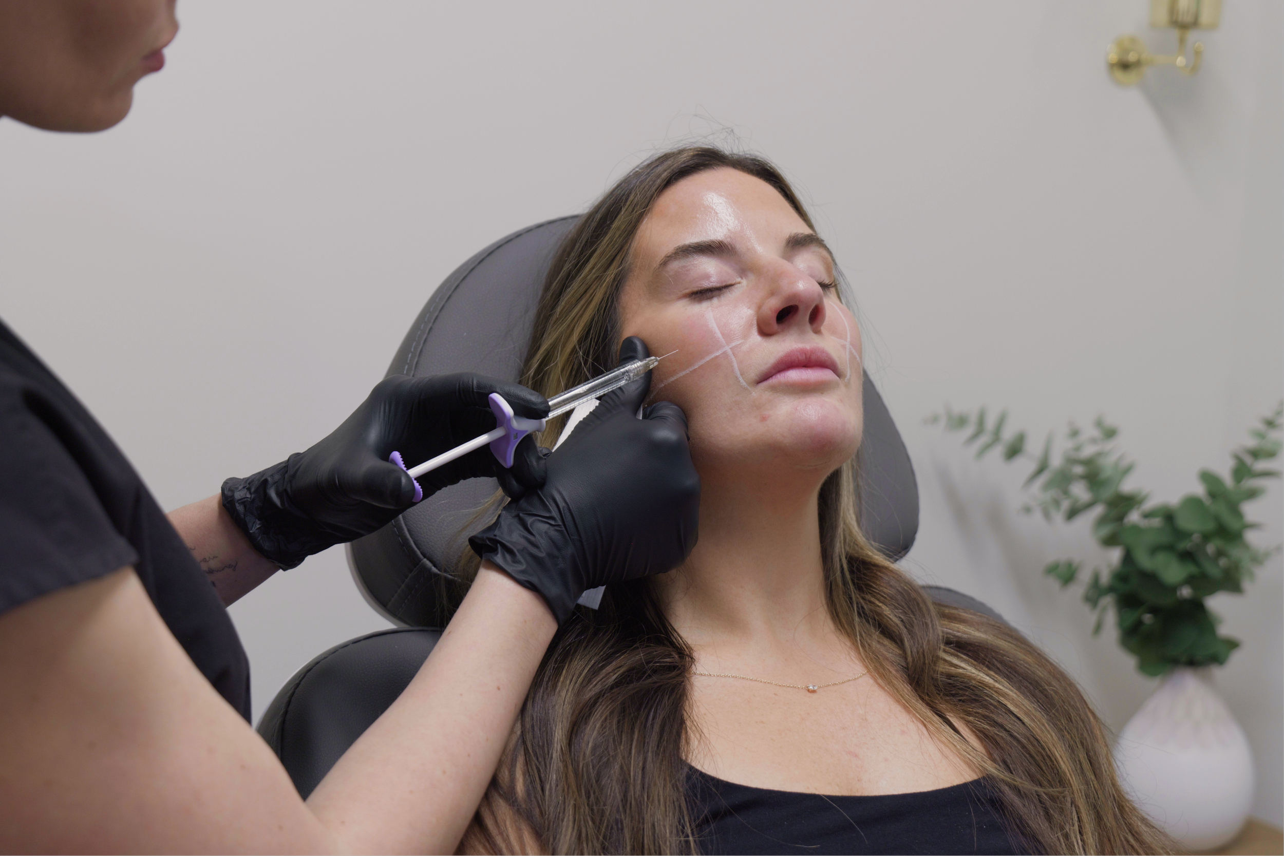 woman receiving injectable filler treatment at bloom apothecary medspa in unionville connecticut