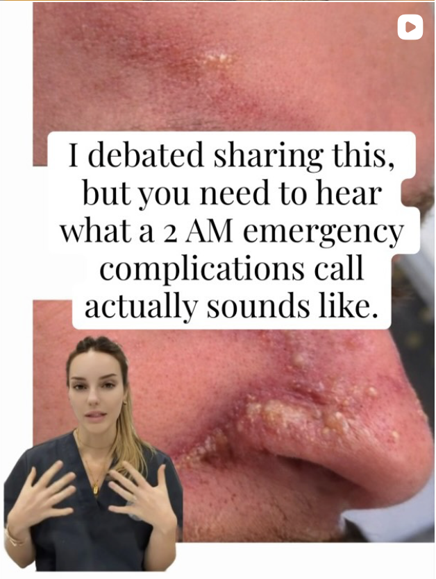 dermal filler course